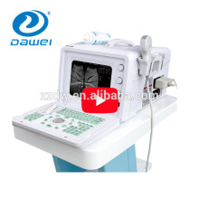 Full digital vet ultrasound scanner for dog cat,cow,horse,pig,sheep,goat & veterinary ultrasound equipment DW330